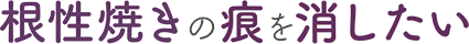 根性焼きの痕を消したい